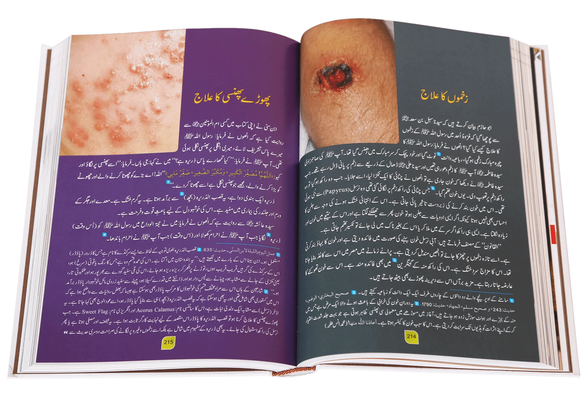 Tib-e-Nabvi (Latest) - Ibn al Qayyim - Image 5